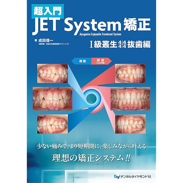 Amazon.co.jp: 埋伏歯 Impacted teeth : Vincent G. Kokich, David P